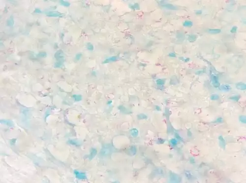 Patho Web - Screenshot 13